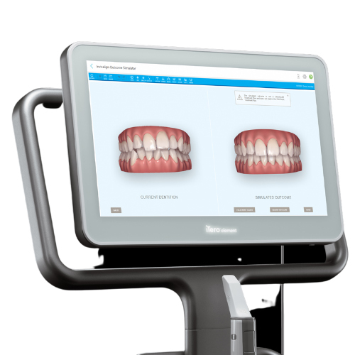 マウスピース矯正だけでは治せない場合がある
