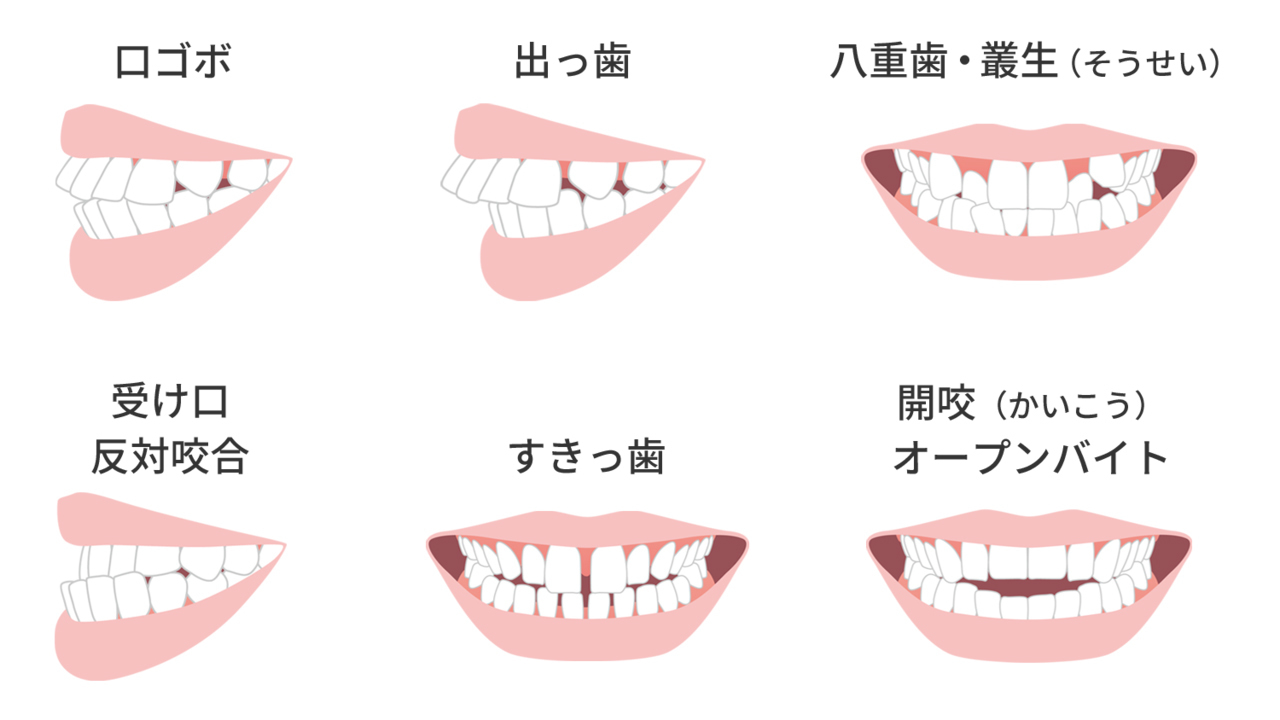 どんな歯並びの方もご相談ください - 三重県伊勢市 矯正歯科相談室(鳥羽市、志摩市